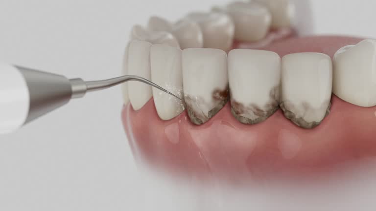 Reliable Wisdom Tooth Removal contractor in Forrest County County, MS by Dentist Open Now